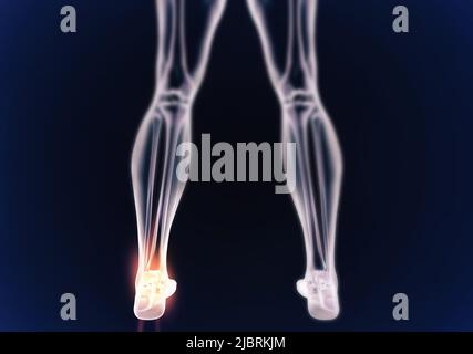 Angle and joint pains. When inflammation strikes. Illustration of the human body indicating the skeletal structure. Stock Photo