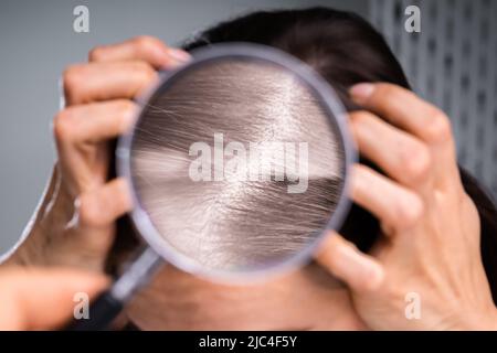 Dermatologist's Hand Examining Woman's Hair With Magnifying Glass Stock Photo