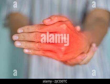 Metacarpophalangeal joints inflammation. Concept and idea of rheumatic arthritis, gout, hand joint swelling or arthralgia. Stock Photo