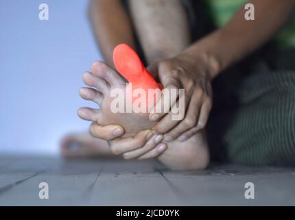 Inflammation of Asian young man’s big toe. Concept of foot joint pain, arthritis, stumble, hyperuricema or gout. Stock Photo