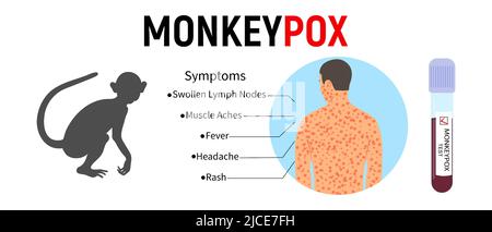 Monkeypox virus cell with monkey silhouette and text on white ...