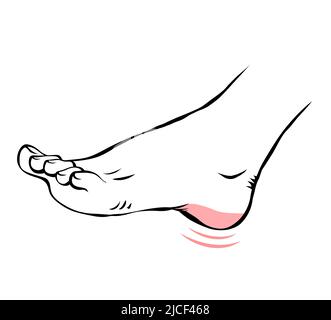 Line sketch female leg with problematic pain. Sore heel. Orthopedic disease plantar fasciitis. Beauty and health of feet. Vector isolated outline illu Stock Vector