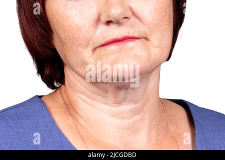 The lower part of the face and neck of an elderly woman with signs of skin aging isolated on a white background. Age-related changes, flabby sagging s Stock Photo