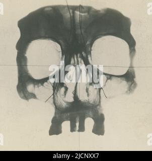 Human skull, X-ray. Stock Photo