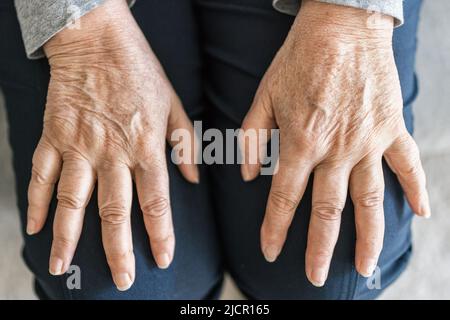 Senior woman at home suffering from arthritis Stock Photo