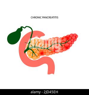 Pancreas duct anatomy for medical concept 3D illustration Stock Photo ...