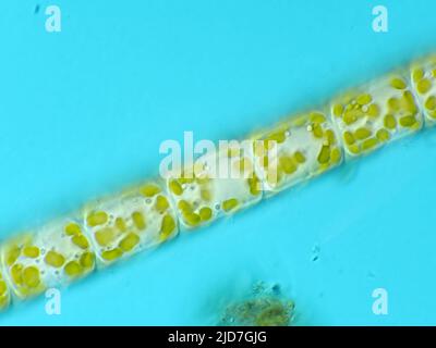 Melosira diatoms under the microscope Stock Photo