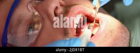 A man treats teeth, a patient's calm face close-up Stock Photo