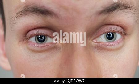 Mature man opens eyes looking straight in camera macro Stock Photo