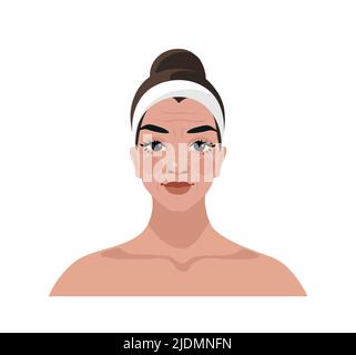 Middle aged woman with age changes flat cartoon icon isolated on white. Female portrait for advertising cosmetics, beauty treatments, beauty injection Stock Vector