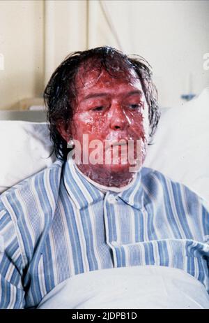 MICHAEL GAMBON, THE SINGING DETECTIVE, 1986 Stock Photo