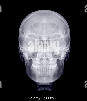 Skull x-ray image of Human front view  isolated on Black Background. Stock Photo