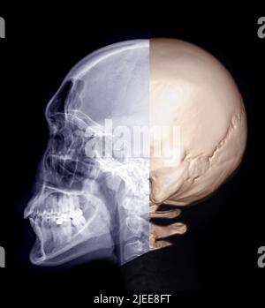 Skull x-ray image of Human lateral view and 3D rendering  image  isolated on Black Background. Stock Photo