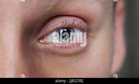 Mature man opens eyes looking straight in camera macro Stock Photo