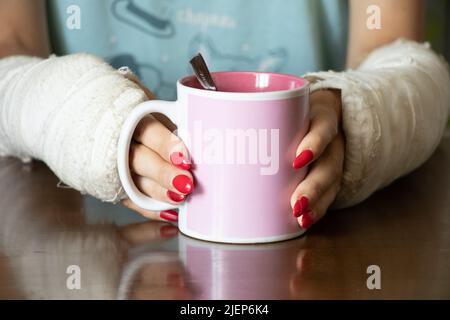 a girl with two broken arms in a cast holds a cup of tea in the kitchen for breakfast, broken arms in a cast, fractured limbs, injury Stock Photo