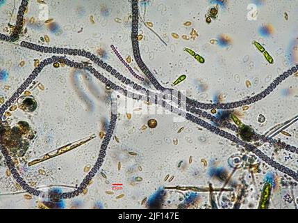 Nostoc sp. blue green algae under microscopic view with Toxic Water ...