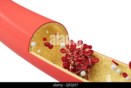 Red and white blood cells in blood vessels, 3d rendering. Computer digital drawing. Stock Photo