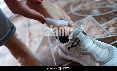 Hallux valgus on legs of woman with retainer puts on sneakers closeup Stock Photo