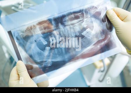 X-ray panoramic picture of human teeth Stock Photo