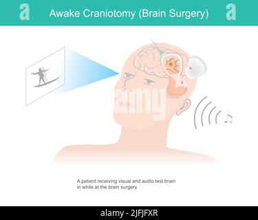 Awake craniotomy. A patient receiving visual and audio test brain in while at brain surgery. Stock Vector