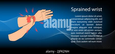 Graphics Design paper brochure, Broken or Sprained Wrist Diagram vector illustration blue color tone background Stock Vector