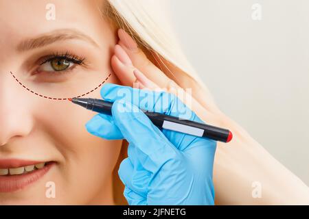 Plastic surgeon drawing dashed line under eye of girl. Hand in blue glove holding pencil. Plastic surgery, beauty portrait, closeup. Stock Photo