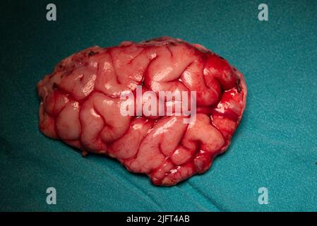 Surgical specimen of brain at frontal lobe causing seizure on green table Stock Photo