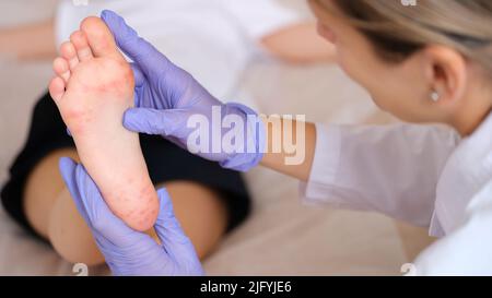 Doctor examining foot of child with red itchy rashes in clinic closeup Stock Photo