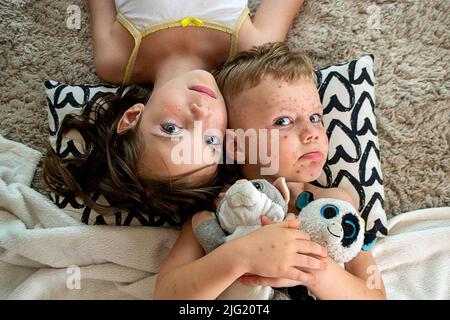 Natural vaccination. Contagious disease.  Stock Photo