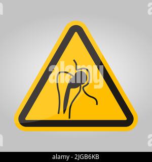 No Access For People With Metallic Implants Stock Vector