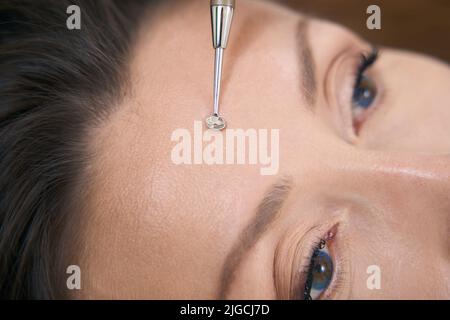 Close up of forehead acne removal with uno spoon Stock Photo