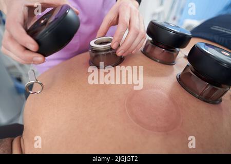 Man receiving vacuum therapy treatment in physiotherapy clinic Stock Photo