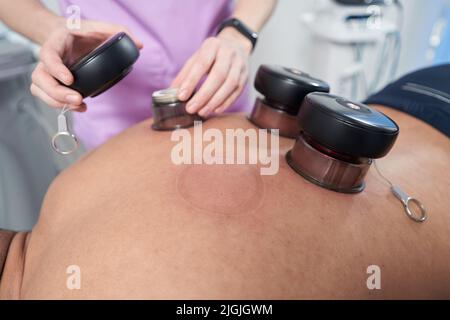 Male patient receiving vacuum therapy treatment in clinic Stock Photo