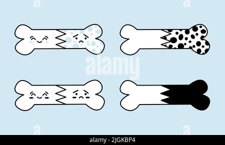 Set of osteoporosis destroyed bones. Orthopedic bone elements for World Osteoporosis Day. Happy healthy bone vs sad sick Stock Vector
