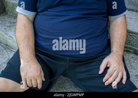 fat, obese man's belly close up with diabetes and in ill health outdoors sitting Stock Photo