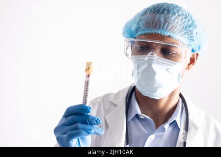 African american male doctor wearing face mask, holding vial with monkeypox virus Stock Photo