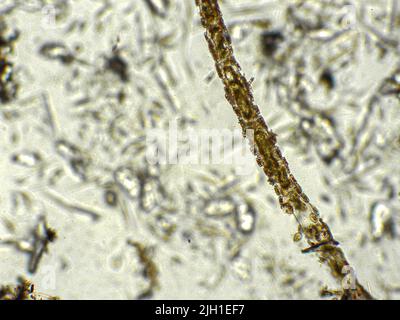 Diatoms under microscopic view Stock Photo