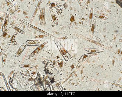 Diatoms under microscopic view Stock Photo