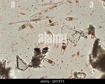 Diatoms under microscopic view Stock Photo