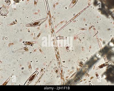 Diatoms under microscopic view Stock Photo