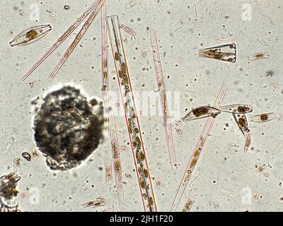 Diatoms under microscopic view Stock Photo