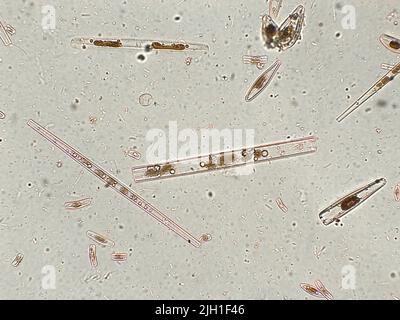 Diatoms under microscopic view Stock Photo