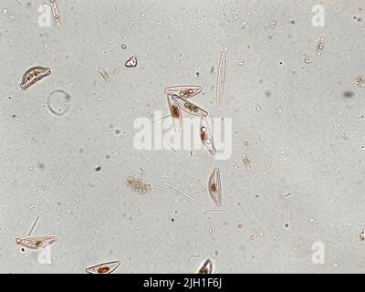 Diatoms under microscopic view Stock Photo