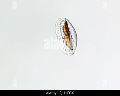 Amphora sp. algae under microscopic view, Diatoms, phytoplankton, fossils, silica, golden yellow algae Stock Photo