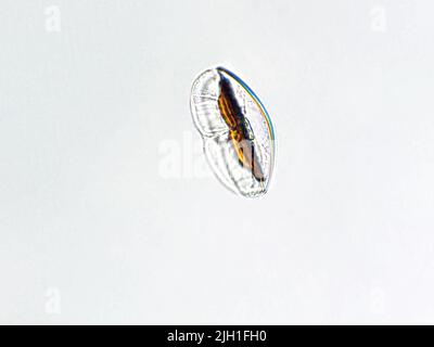 Amphora sp. algae under microscopic view, Diatoms, phytoplankton, fossils, silica, golden yellow algae Stock Photo