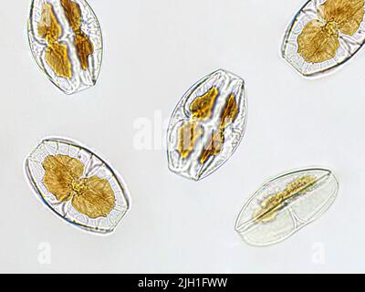 Amphora sp. algae under microscopic view, Diatoms, phytoplankton, fossils, silica, golden yellow algae Stock Photo