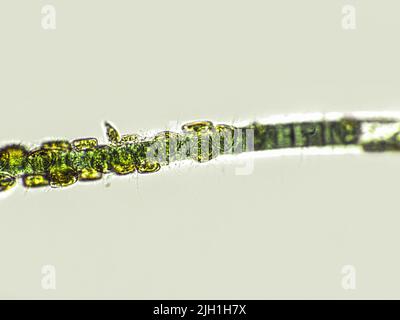 Blue-green filamentous algae under microscopic view, cyanobacteria ...