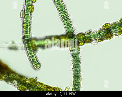 Blue-green filamentous algae under microscopic view, cyanobacteria ...