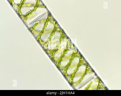 Spirogyra sp. algae under microscopic view, Chlorophyta Stock Photo