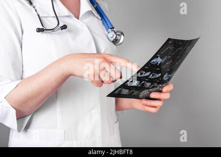 Doctor studying CT or MRI scan results. Diagnostics conducting for detecting diseases or injuries. Health care, medicine concept. Checking for medical problems. High quality photo Stock Photo
